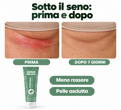 Derma Relivia Crema Lenitiva per Irritazioni da Sfregamento e Sudore